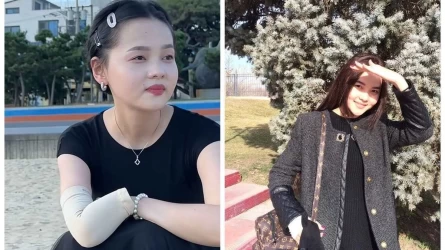 «Áke-sheshemnіń salǵyrttyǵy sebep boldy»: Onkologııamen aýyryp, qolyn kesýge májbúr bolǵan arý qazaqstandyqtardan kómek surady (VIDEO)