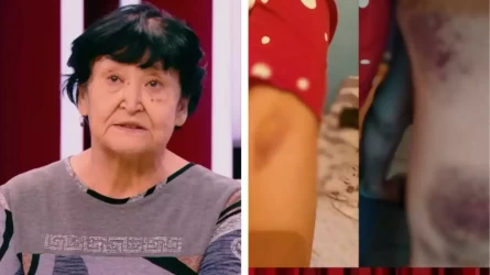 "Mynalar tіsterі": almatylyq kelіnshek kúıeýbalasynyń qalaı uryp-soqqanyn aıtty