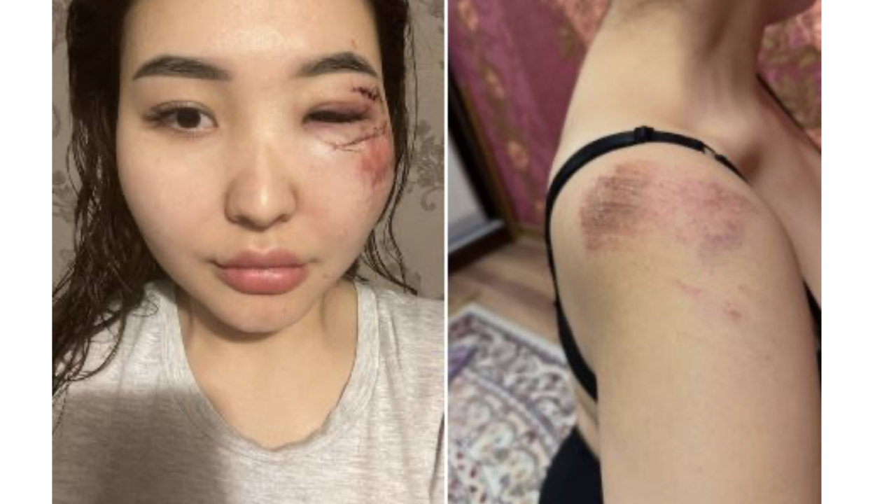 Атырауда блогерді ұрып-соққан 2 күдікті әйел ұсталды