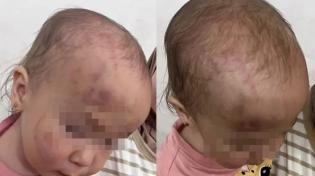 Ақтауда соққыға жығылған сәбидің анасы істі жабайын деп жатыр деп дабыл қақты