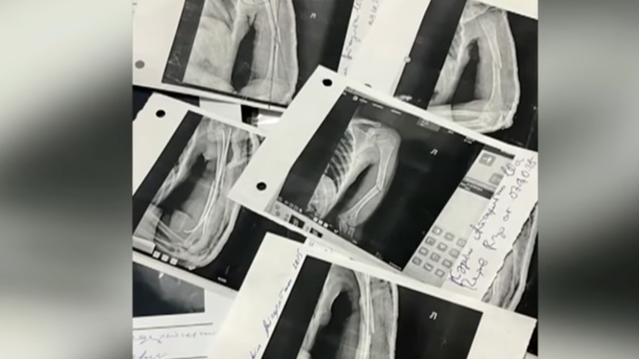 В Актобе старшеклассник сломал руку 10-летнему школьнику на территории школы