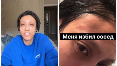 «Бұрынғы «КНБ-шник» екенін айтты»: белгілі әншіні көршісі ұрып-соққан (видео)