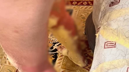 Ақтаулық бала жылу батареясынан атқылаған ыстық суға күйіп қалды