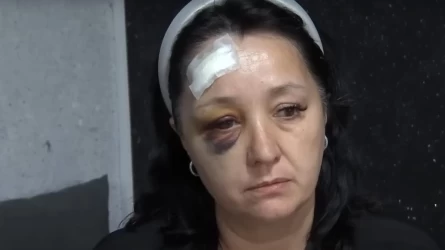 «Ешқашан өштескен емеспіз»: Алматыда 45 жастағы әйелді құдасы дубинкамен көшеде ұрып кеткен