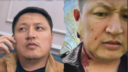 «Соңына дейін барамын»: Нұрболхан Шарапов қан-жоса күйінде көрінді