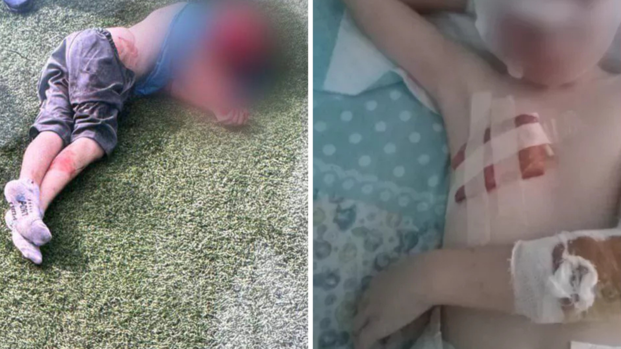 Ит талаған баланың отбасы баспаналы болды