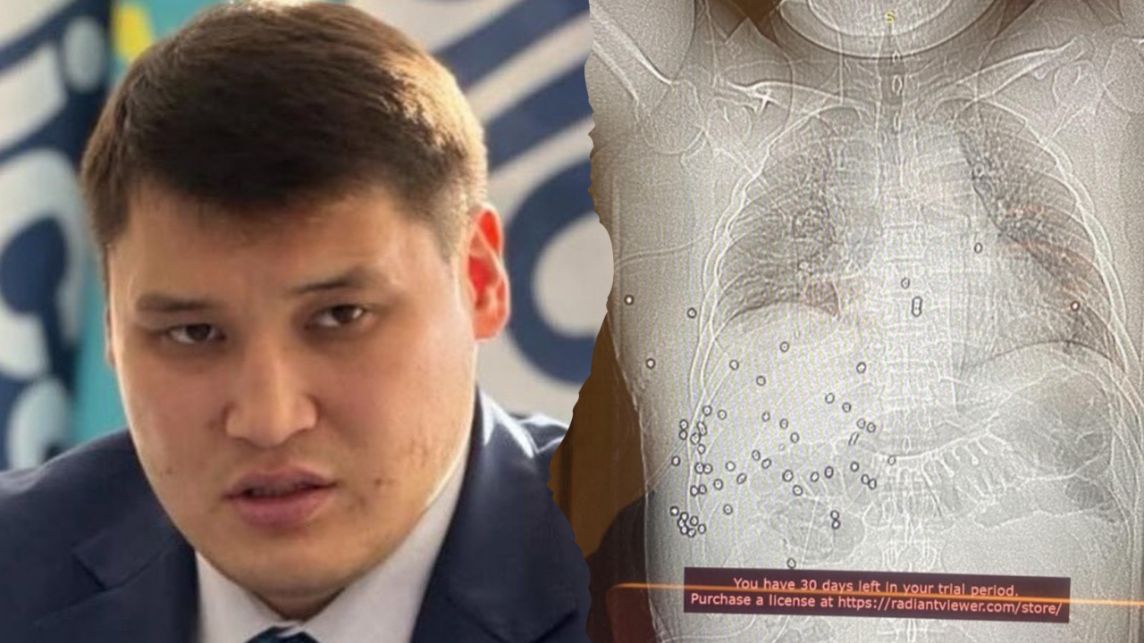 Берденов денесінде 60-тан астам бытыра оқ қалғанын көрсетті (ФОТО)
