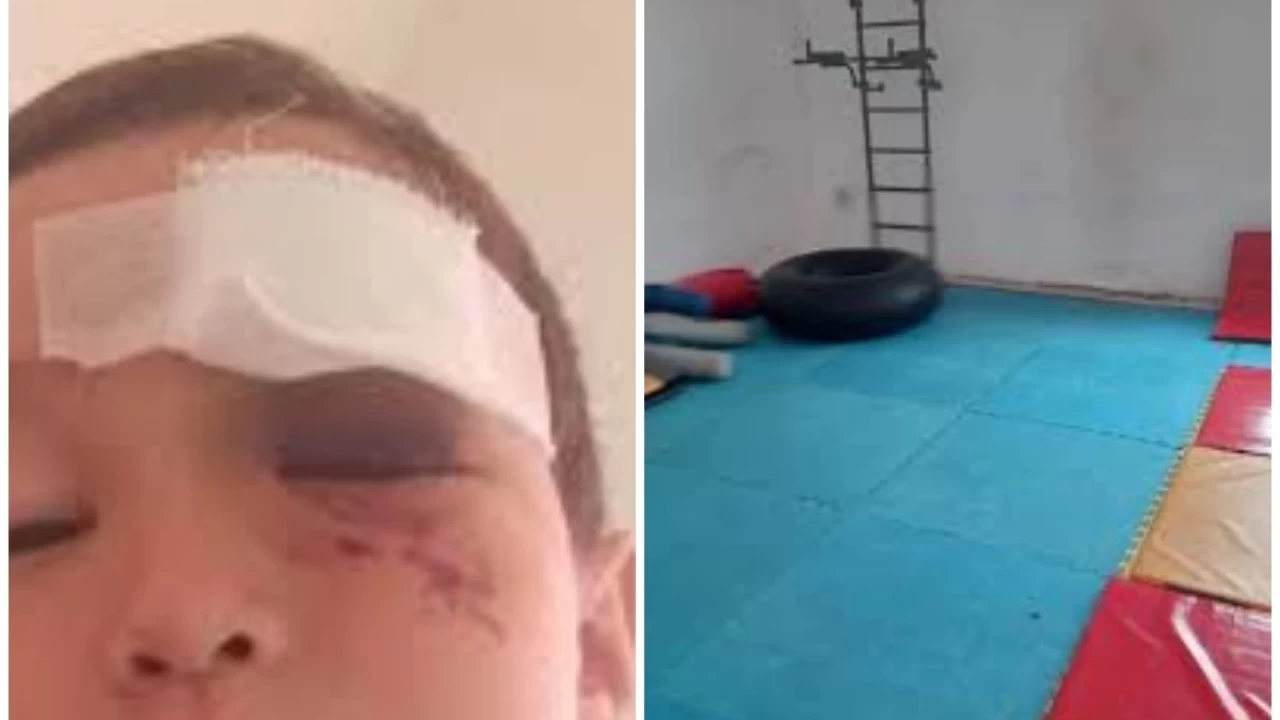 Оралда 5 жастағы бала жаттығу кезінде жарақат алып, бір көзінен айырылды