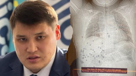 Берденов денесінде 60-тан астам бытыра оқ қалғанын көрсетті (ФОТО)