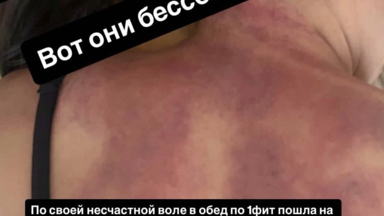 Ақтаулық тұрғын 1Fit арқылы жазылған массаждан көк ала қойдай боп қайтты