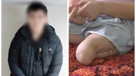 11-летняя девочка стала инвалидом: после ДТП в Шымкенте водитель не выплачивает компенсацию