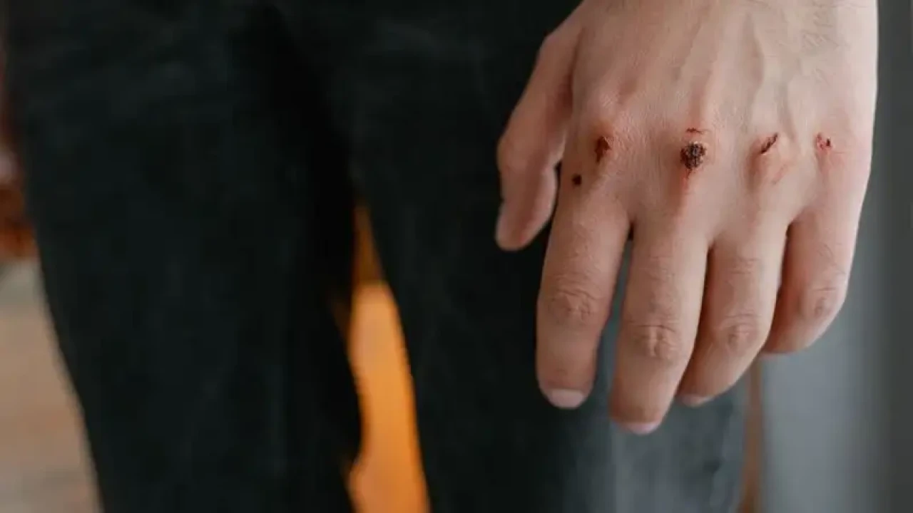 Қарасай ауданында ер адам көршісінің ішінен теуіп, кінәсін мойындамады