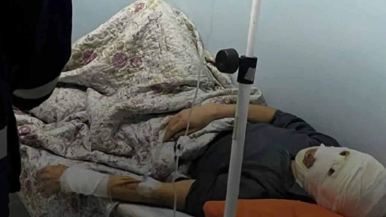 Маңғыстауда жанармай бекетінде жарылыс болып, жұмысшыны ауыр күйік шалды