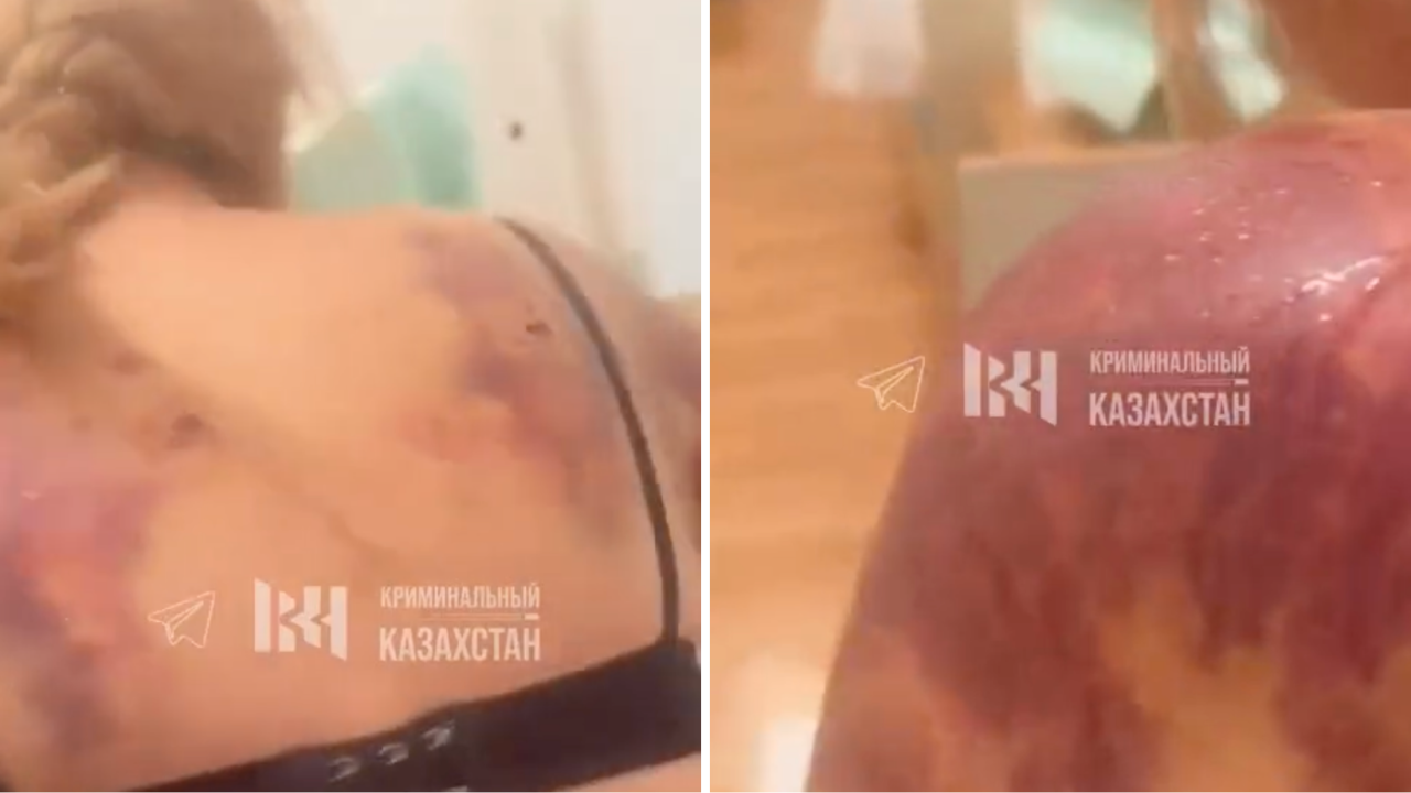 Алматы облысында мас еркек әйелді күрекпен ұрып, қолын сындырған (ВИДЕО)