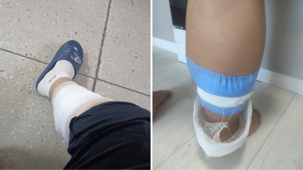 Көкшетауда он шақты қаңғыбас ит жүкті әйелге шабуыл жасады