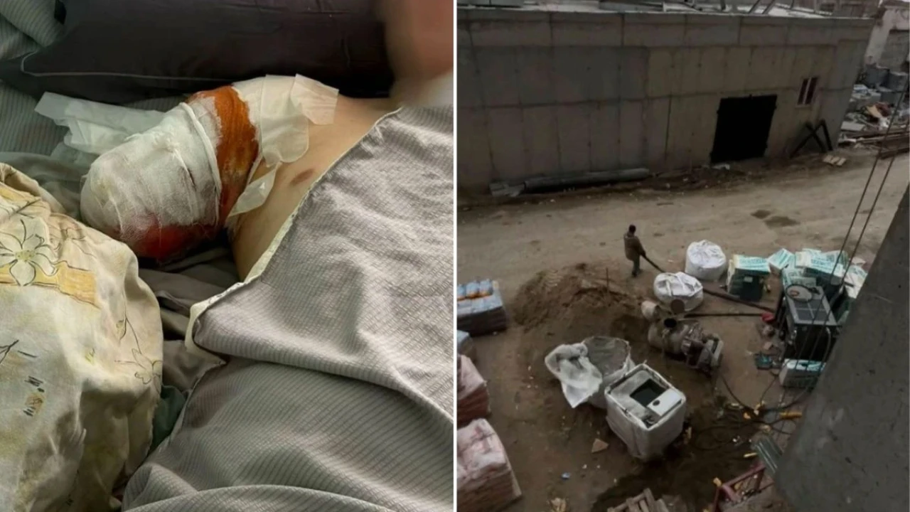 Семейдегі құрылыс алаңында жараланған 20 жастағы жігіт қолынан айырылды