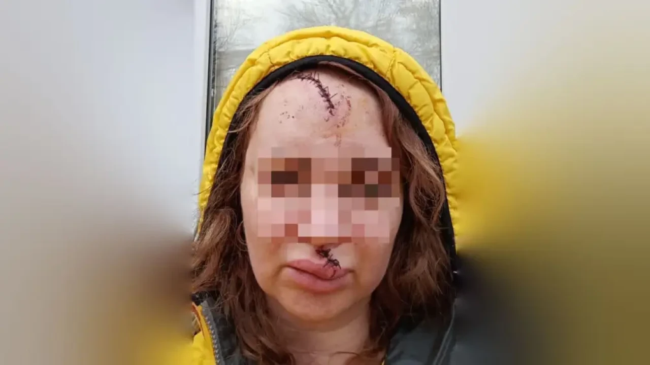 «Тістері сынған, беті бүлінген»: Петропавлда куәгер әйелді аяусыз соққыға жыққан