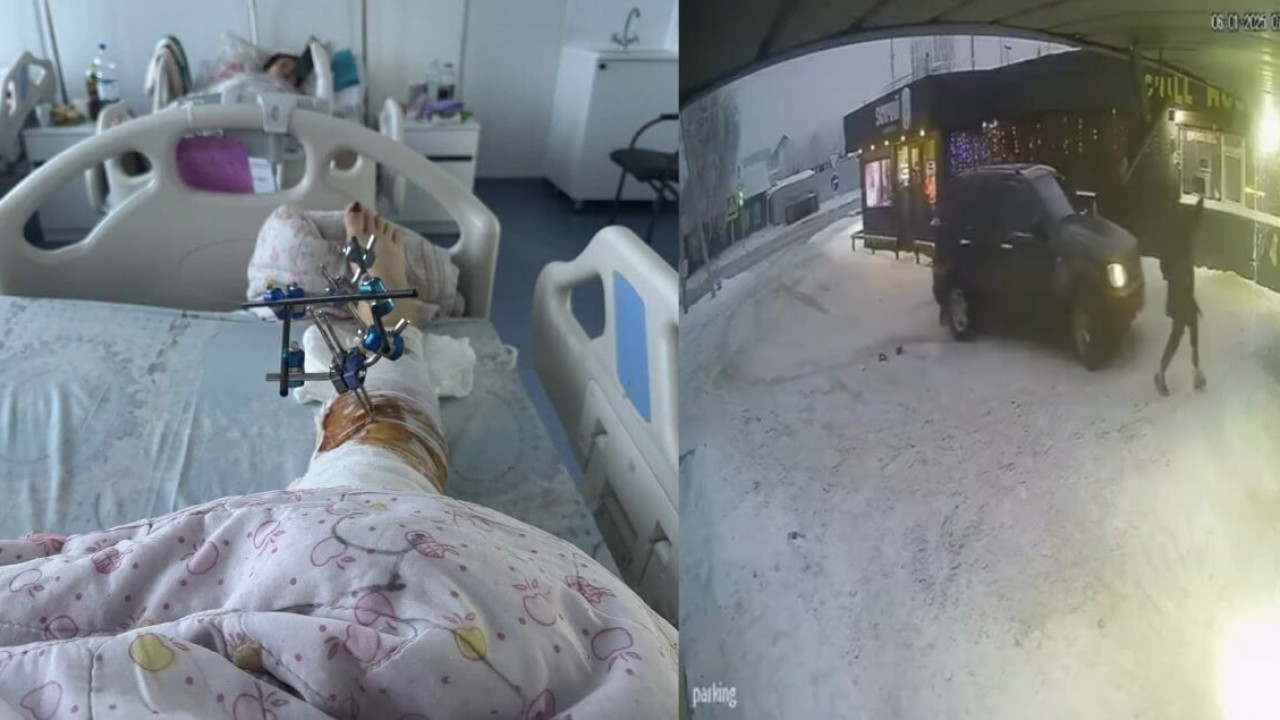 Павлодарда ер адам сүйіктісін көлікпен қабырғаға қысып, аяғынан айырды