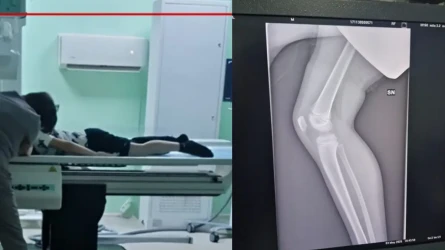 «Артыңа ағаш тығамыз»: Степногорскте 1-сынып оқушысын бірнеше бала жабылып ұрып кеткен