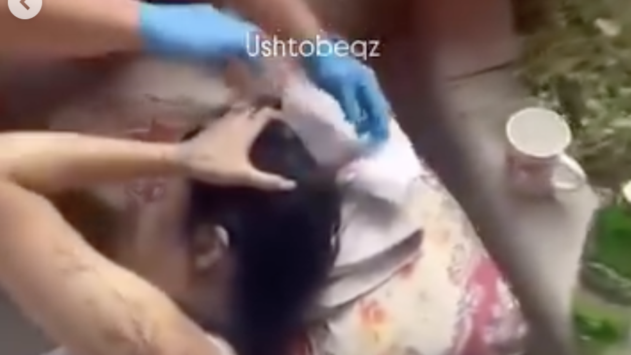В Уштобе на девушку упала сухая ветка дерева