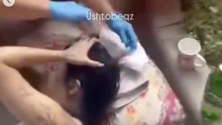 В Уштобе на девушку упала сухая ветка дерева