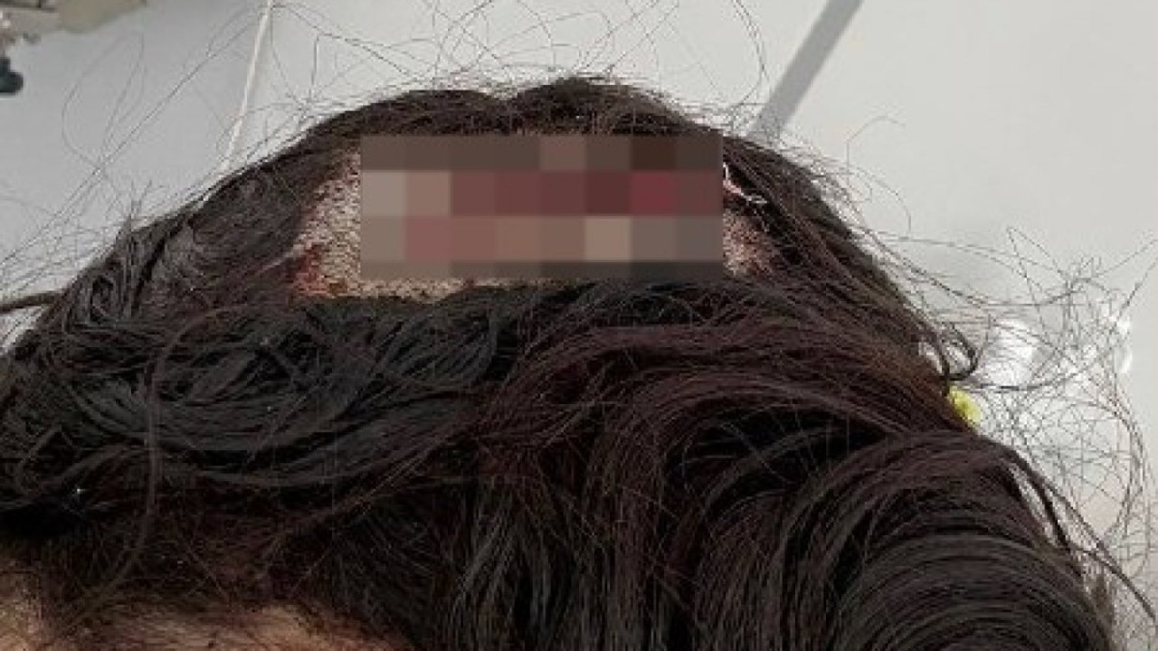 Стало известно, кто уронил лед на голову женщине в Павлодаре