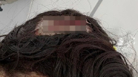 Стало известно, кто уронил лед на голову женщине в Павлодаре