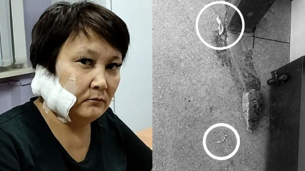 В ВКО бывший муж отрезал ухо матери шестерых детей