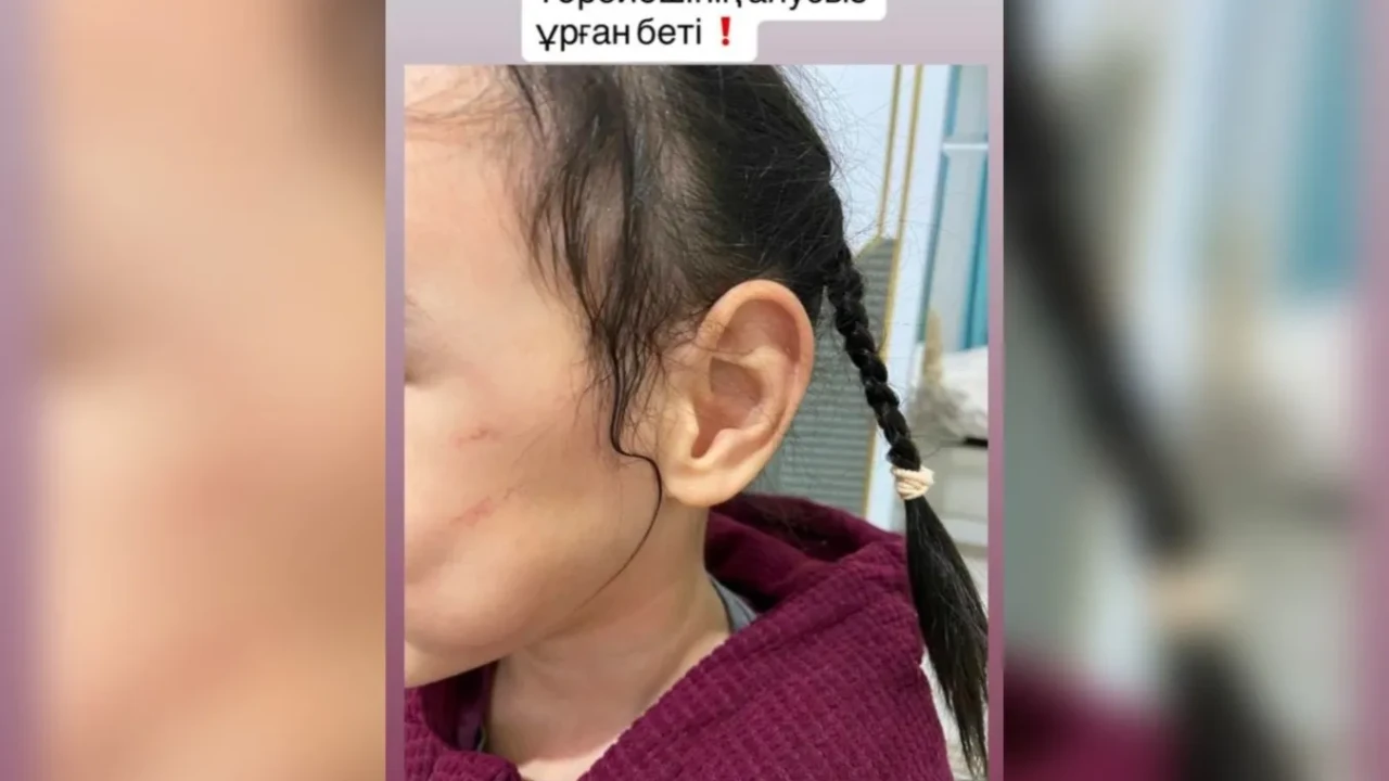 «Қызымды ұрып жіберген»: Астанадағы балабақшада балаға қатысты дау шықты
