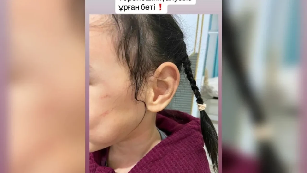 Астанада жекеменшік балабақша тәрбиешісі балаға күш көрсетті деген күдікке ілінді