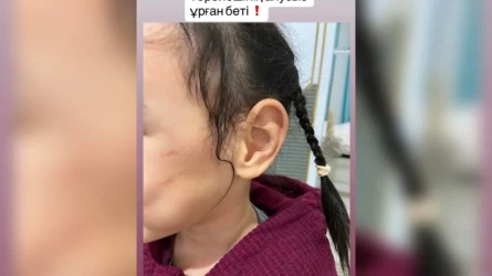 «Қызымды ұрып жіберген»: Астанадағы балабақшада балаға қатысты дау шықты